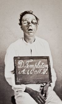 David R. Templeton, Co A 46 NY, Wounded at Petersburg, April 2, 1865