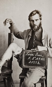 Lorin True, Co K  2 NY Heavy Artillery, Wounded at Farmersville, April 7 1865.