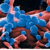 H5N1 bird flu virus