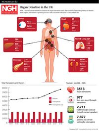 Live Organ Transplants