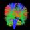 These are axonal nerve fibers in the real brain as determined by the measured anisotropy (directionality) of water molecules inside them. 3T 30 channel GRAPPA DTI scan protocol, deterministic tractogr