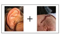 Ear plus worm