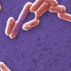 e coli