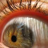 eye close