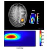 FMRI lie detector