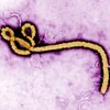 A colorized transmission electron micrograph (TEM) of a Ebola virus virion.