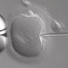 IVF in vitro fertilization