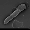 Face mite observed through SEM microscope