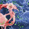 Scanning electron micrograph of HIV-1 budding (in green) from cultured lymphocyte. This image has been colored to highlight important features. 