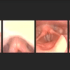 Here’s A Close-Up Of Vocal Cords In Action, And It’s Not Weird At All
