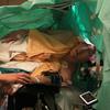 Watch: Opera Singer Performs During His Own Brain Surgery