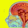 Mri T2 Of A Normal Brain Mid Sagittal View. 