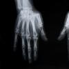 X-ray of human hands