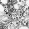 a black and white microscope image that shows many circles. smaller circles with thick black edges (the corona) are the SARS coronavirus.
