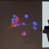 A photographer casts a shadow taking a photo of a projector image showing red and blue shapes -- immunofluorescence staining of omicron infected Vero E6 cells in Hong Kong, Wednesday, Dec. 1, 2021.