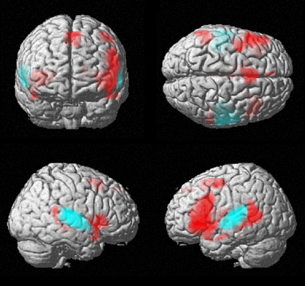 Зрение полушария мозга. Человек с одним полушарием. Left Brain right Brain. Left Hemisphere of Brain. Мозг полушария какой цвет.