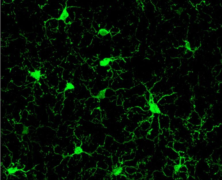 Bringing Gamma Back Radiolab
