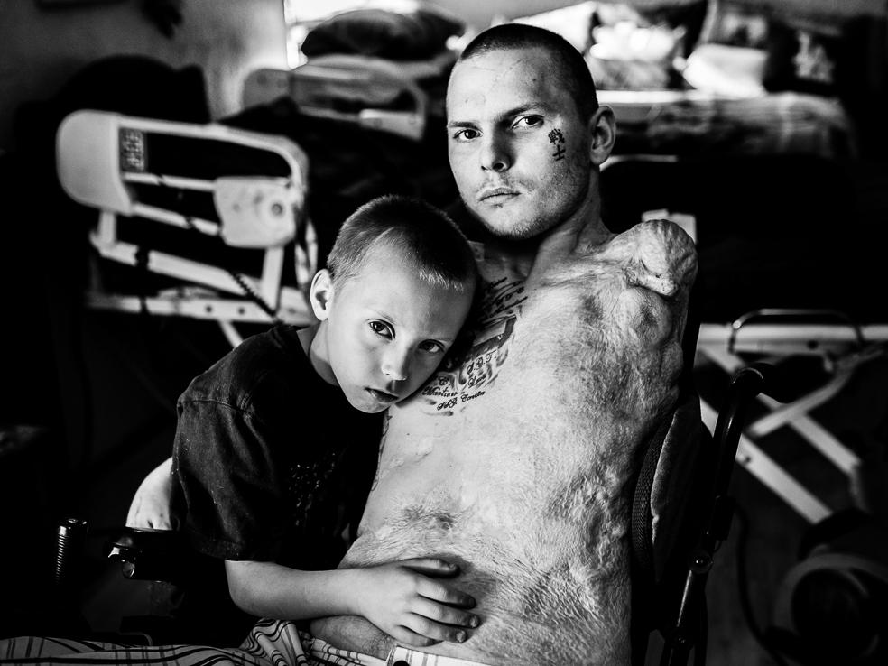 It's Not Rude: These Portraits Of Wounded Vets Are Meant To Be Stared ...