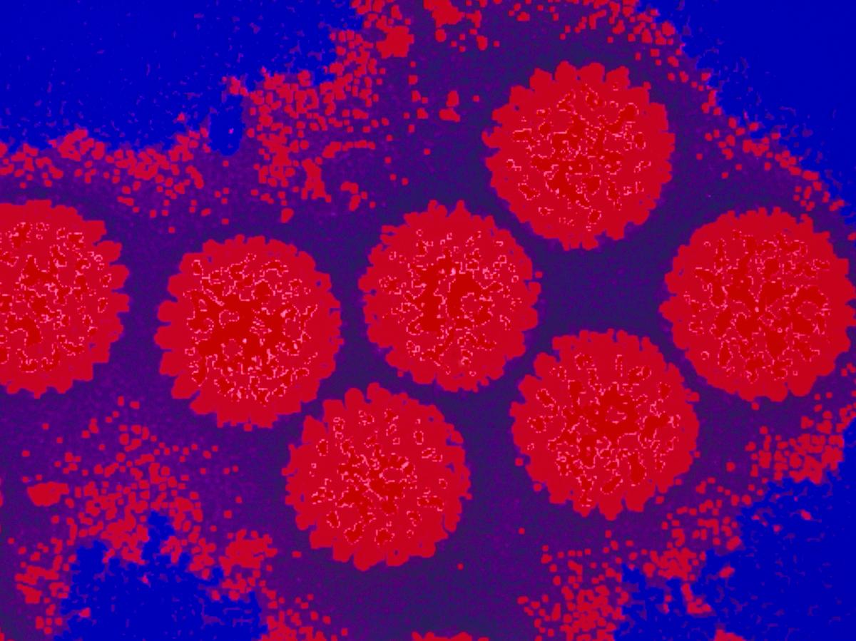 Ротавирус как выглядит под микроскопом Scientists Discover The Secret Weapon Of Stomach Viruses NPR Article WNYC