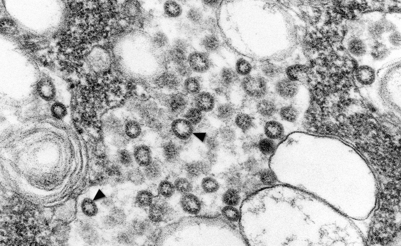 Coronavirus under Microscope