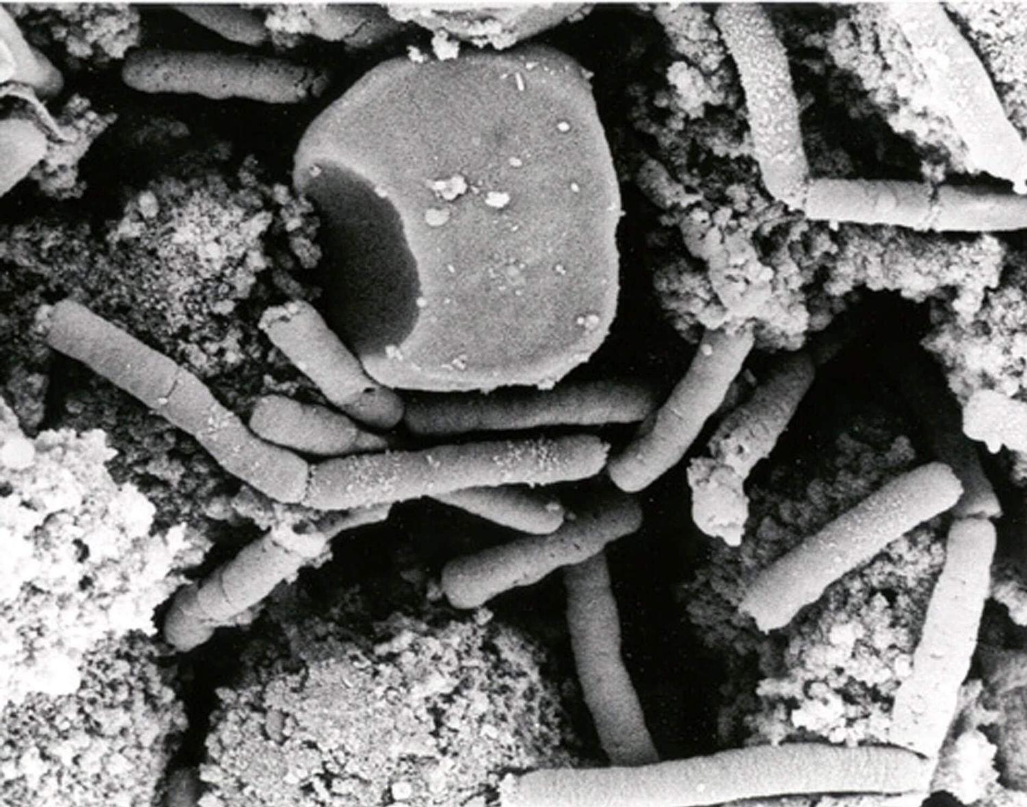 unrestricted-access-to-anthrax-and-other-disturbing-findings-at-the-cdc