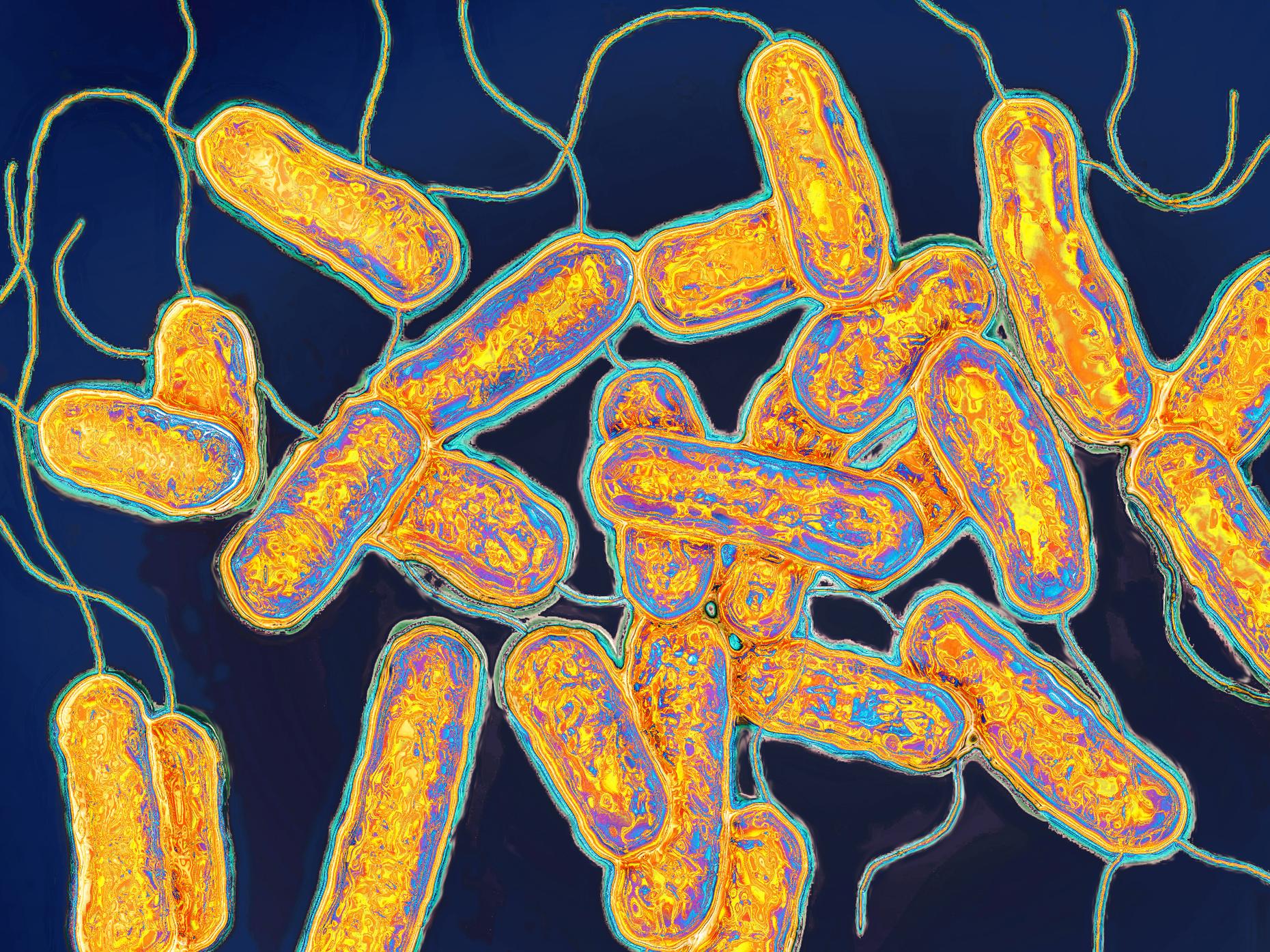 How To Stop An Outbreak Only Human Wnyc Studios - 