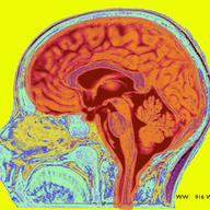 Mri T2 Of A Normal Brain Mid Sagittal View.