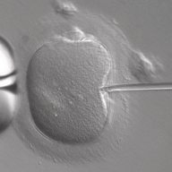 IVF in vitro fertilization