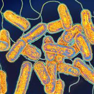 Legionella bacterium