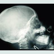 Skull and Hand, circa 1900.