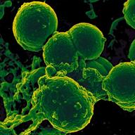 Neutrophil and Methicillin-resistant Staphylococccus aureus (MRSA) Bacteria