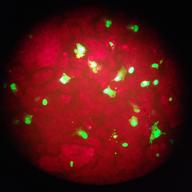 human cells infected with the flu virus glow green under light from a fluorescence microscope, at the Seattle-King County Dept. of Public Health's laboratory in Seattle. 