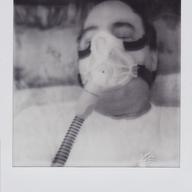 Sleep apnea