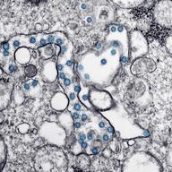 an electron microscope picture. it's colored black and white, except highlighted in blue are circular viruses