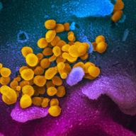 Image shows microscopic look at the COVID-19 virus in a sample from a patient.