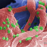 HIV 