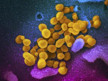This undated electron microscope image made available by the U.S. National Institutes of Health in February 2020 shows the Novel Coronavirus SARS-CoV-2, yellow, emerging from the surface of cells.